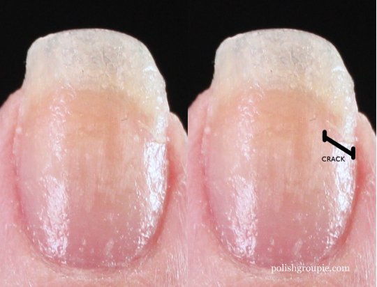 DIY Tea Bag Nail Repair